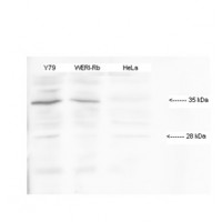 Antibody used in WB on Human cell lines at 1:1000.