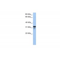 Antibody used in WB on Human 721_B at 0.2-1 ug/ml.