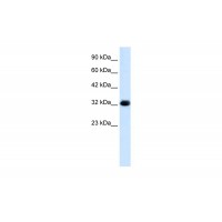 Antibody used in WB on Human HepG2 at 1.25 ug/ml.