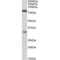 Western Blot (1μg/ml) staining of Human Duodenum lysate (35μg protein in RIPA buffer). Primary incubation was 1 hour. Detected by chemiluminescence.