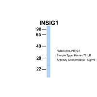 Antibody used in WB on Human 721_B at 1 ug/ml.