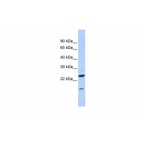 Antibody used in WB on Human Brain at 0.2-1 ug/ml.