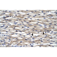 Antibody used in IHC on Human Heart lysate.