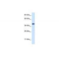 Antibody used in WB on Human Cerebellum at 1.25 ug/ml.