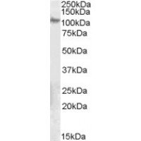 Western Blot (0.1μg/ml) staining of Human Ovary lysate (35μg protein in RIPA buffer). Primary incubation was 1 hour. Detected by chemiluminescence.