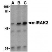 Western blot analysis of IRAK2 in A-20 whole cell lysate with IRAK2 antibody (C2) at (A) 0.5, (B) 1, and (C) 2 μg/mL.