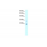 Antibody used in WB on Human HepG2 at 2.0 ug/ml.
