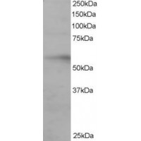 Western Blot staining (0.2μg/ml) of Human Ovary lysate (RIPA buffer, 35μg total protein per lane). Primary incubated for 1 hour. Detected by western blot using chemiluminescence.