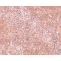 Immunohistochemistry of JMJD8 in mouse spleen tissue with JMJD8 antibody at 2.5 μg/mL.