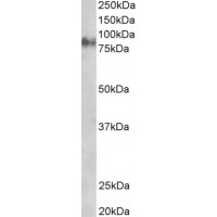 Western Blot staining (1μg/ml) of Rat Eye lysate (RIPA buffer, 35μg total protein per lane). Primary incubated for 1 hour. Detected by western blot using chemiluminescence.