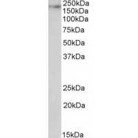 Western Blot (0.1μg/ml) staining of Rat Brain lysate (35μg protein in RIPA buffer). Primary incubation was 1 hour. Detected by chemiluminescence.