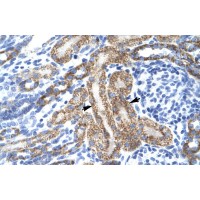 Antibody used in IHC on Human kidney.
