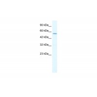 Antibody used in WB on Human Jurkat 1.25 ug/ml.