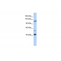 Antibody used in WB on Human HeLa at 0.2-1 ug/ml.