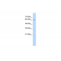 Antibody used in WB on Human HepG2 at 2.5 ug/ml.