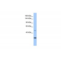 Antibody used in WB on Human Liver at 0.2-1 ug/ml.