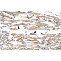 Antibody used in IHC on Human Muscle.