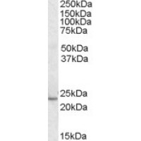 Western Blot (0.3μg/ml) staining of Human Heart lysate (35μg protein in RIPA buffer). Primary incubation was 1 hour. Detected by chemiluminescence.