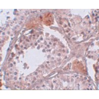 Immunohistochemistry of CLPH in human testis tissue with CLPH antibody at 5 μg/mL.
