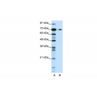 Antibody used in WB on Human Jurkat 1.25 ug/ml.