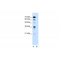 Antibody used in WB on Human Jurkat 0.2-1 ug/ml.