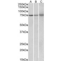 Western Blot (2μg/ml) staining of Human (A), Mouse (B) and Rat (C) Spleen lysate (35μg protein in RIPA buffer). Primary incubation was 1 hour. Detected by chemiluminescence.