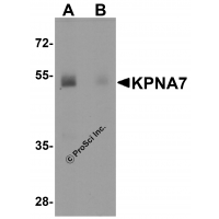 Western blot analysis of KPNA7 in human spleen with KPNA7 antibody at 1 μg/ml in (A) the absence and (B) the presence of blocking peptide.