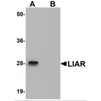 Western blot analysis of LIAR in mouse kidney tissue lysate with LIAR antibody at 1 μg/mL in (A) the absence and (B) the presence of blocking peptide.