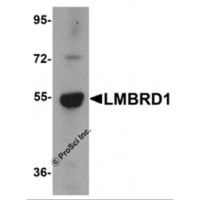 Western blot analysis of LMBRD1 in human brain tissue lysate with LMBRD1 antibody at 1 μg/mL.