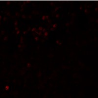 Immunofluorescence of LMBRD1 in human brain tissue with LMBRD1 antibody at 20 μg/mL.