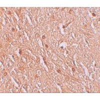 Immunohistochemistry of LMBRD1 in human brain tissue with LMBRD1 antibody at 2.5 μg/mL.