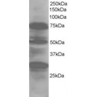 Western Blot staining (1μg/ml) of Human Lung lysate (RIPA buffer, 30μg total protein per lane). Primary incubated for 1 hour. Detected by western blot using chemiluminescence.
