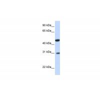 Antibody used in WB on Human Muscle at 0.2-1 ug/ml.