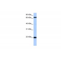 Antibody used in WB on Human Jurkat 0.2-1 ug/ml.