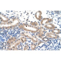 Antibody used in IHC on Human kidney.