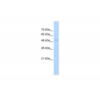 Antibody used in WB on Human Jurkat 2.5 ug/ml.