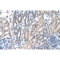 Antibody used in IHC on Human kidney.