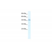 Antibody used in WB on Human Jurkat 2.5 ug/ml.