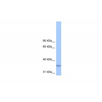Antibody used in WB on Human HeLa at 0.2-1 ug/ml.