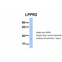 Antibody used in WB on Hum. Fetal Brain at 1 ug/ml.