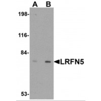 Western blot analysis of LRFN5 in EL4 cell lysate with LRFN5 antibody at (A) 0.5 and (B) 1 μg/mL.