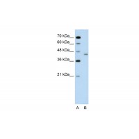 Antibody used in WB on Human Jurkat 0.2-1 ug/ml.
