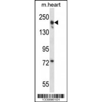 Western blot analysis in mouse heart tissue lysates (35ug/lane).