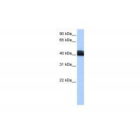 Antibody used in WB on Human MCF-7 at 0.2-1 ug/ml.