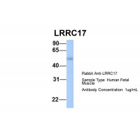 Antibody used in WB on Hum. Fetal Muscle at 1 ug/ml.