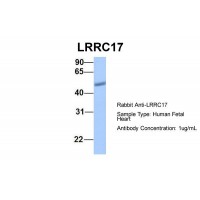 Antibody used in WB on Hum. Fetal Heart at 1 ug/ml.