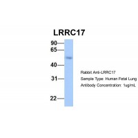 Antibody used in WB on Hum. Fetal Lung at 1 ug/ml.