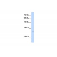 Antibody used in WB on Human HepG2 at 0.25 ug/ml.