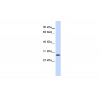 Antibody used in WB on Human HEK293T cells at 0.2-1 ug/ml.