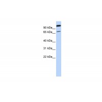 Antibody used in WB on Human 721_B at 0.2-1 ug/ml.